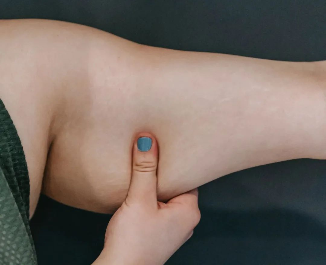 賽樂賽：不同肥胖類型，應該怎么減肥